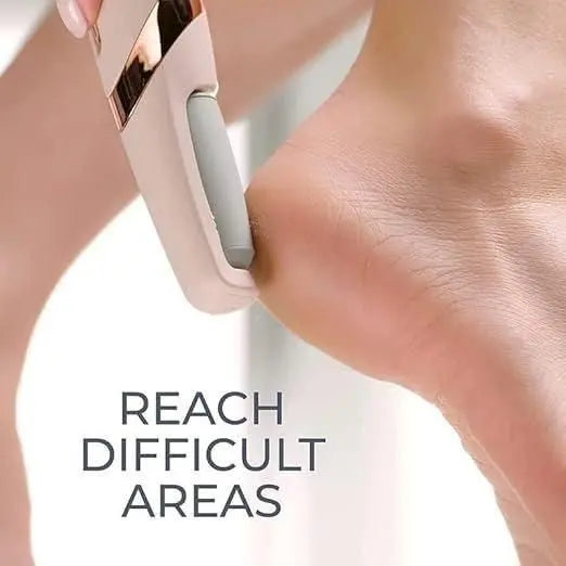 Electronic Tool File and Callus Remover, Foot File Callus Remover Too