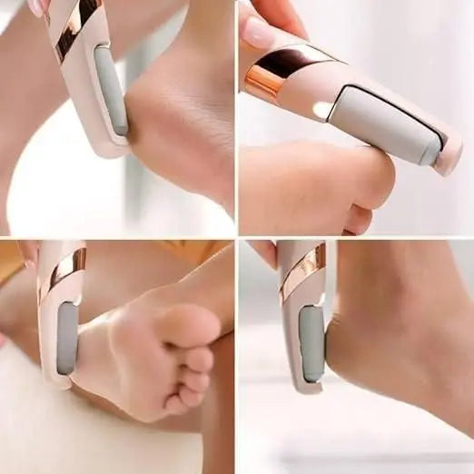 Electronic Tool File and Callus Remover, Foot File Callus Remover Too
